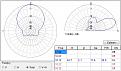 Clicca sull'immagine per ingrandirla. 

Nome:   17m-MMANA-TAPERING.jpg 
Visite: 389 
Dimensione: 58.8 KB 
ID: 90067